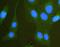 Scribble Planar Cell Polarity Protein antibody, A01651, Boster Biological Technology, Immunofluorescence image 