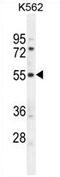 Testis Expressed 9 antibody, AP54223PU-N, Origene, Western Blot image 