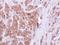 OCRL Inositol Polyphosphate-5-Phosphatase antibody, NBP2-19621, Novus Biologicals, Immunohistochemistry paraffin image 