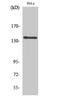 Mov10 Like RISC Complex RNA Helicase 1 antibody, A09677, Boster Biological Technology, Western Blot image 