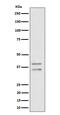 Ubiquitin Recognition Factor In ER Associated Degradation 1 antibody, M32358-1, Boster Biological Technology, Western Blot image 