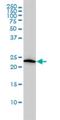 VHL Binding Protein 1 antibody, H00007411-M01, Novus Biologicals, Western Blot image 