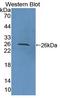 Protein Tyrosine Phosphatase Non-Receptor Type 21 antibody, LS-C703559, Lifespan Biosciences, Western Blot image 