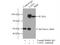 LAS1 Like, Ribosome Biogenesis Factor antibody, 16010-1-AP, Proteintech Group, Immunoprecipitation image 