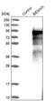 Brain Enriched Guanylate Kinase Associated antibody, NBP1-82907, Novus Biologicals, Western Blot image 