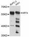Keratin 4 antibody, LS-C747330, Lifespan Biosciences, Western Blot image 