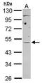 Eukaryotic Translation Initiation Factor 4A3 antibody, PA5-30329, Invitrogen Antibodies, Western Blot image 