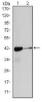 Actin Alpha 2, Smooth Muscle antibody, STJ97812, St John