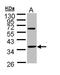 Troponin T1, Slow Skeletal Type antibody, GTX109585, GeneTex, Western Blot image 