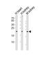 Cystin 1 antibody, PA5-49351, Invitrogen Antibodies, Western Blot image 