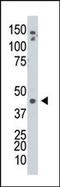 Adenosine Kinase antibody, AP13679PU-N, Origene, Western Blot image 