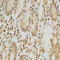 Histone Deacetylase 6 antibody, LS-C331664, Lifespan Biosciences, Immunohistochemistry paraffin image 