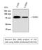 TNF Superfamily Member 11 antibody, STJ96769, St John