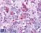 Arginine Vasopressin Receptor 1B antibody, LS-A266, Lifespan Biosciences, Immunohistochemistry frozen image 