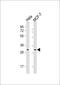 RAB20, Member RAS Oncogene Family antibody, M11018, Boster Biological Technology, Western Blot image 