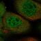 TGF-Beta Activated Kinase 1 (MAP3K7) Binding Protein 3 antibody, PA5-57100, Invitrogen Antibodies, Immunofluorescence image 