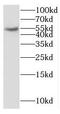 Cytochrome P450 2S1 antibody, FNab02163, FineTest, Western Blot image 