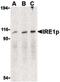 Endoplasmic Reticulum To Nucleus Signaling 1 antibody, PA5-20189, Invitrogen Antibodies, Western Blot image 