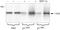 Protein Tyrosine Kinase 2 Beta antibody, 44-618G, Invitrogen Antibodies, Western Blot image 