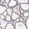 Eukaryotic Translation Initiation Factor 2B Subunit Beta antibody, PA5-61636, Invitrogen Antibodies, Immunohistochemistry paraffin image 