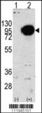 Glycogen Phosphorylase, Muscle Associated antibody, TA302172, Origene, Western Blot image 