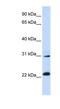 Adaptor Related Protein Complex 3 Subunit Sigma 1 antibody, NBP1-55449, Novus Biologicals, Western Blot image 