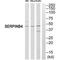 Serpin B4 antibody, PA5-50131, Invitrogen Antibodies, Western Blot image 