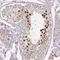 Transcription Factor Like 5 antibody, NBP2-49174, Novus Biologicals, Immunohistochemistry frozen image 