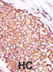 Protein Kinase C Theta antibody, abx033124, Abbexa, Immunohistochemistry frozen image 