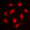 LIM Domain Kinase 1 antibody, LS-C352450, Lifespan Biosciences, Immunofluorescence image 