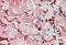 Glutamic-Oxaloacetic Transaminase 1 antibody, PA5-18845, Invitrogen Antibodies, Immunohistochemistry paraffin image 