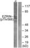 Ezrin antibody, LS-C117352, Lifespan Biosciences, Western Blot image 