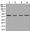 Citrate Synthase antibody, ab129095, Abcam, Western Blot image 