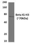Transforming Growth Factor Beta Induced antibody, GTX53070, GeneTex, Western Blot image 