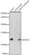 Histone Deacetylase 4 antibody, GTX32646, GeneTex, Immunoprecipitation image 