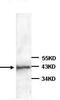 NPHS2 Stomatin Family Member, Podocin antibody, ab93650, Abcam, Western Blot image 