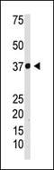 NFKB Inhibitor Alpha antibody, AP12219PU-N, Origene, Western Blot image 