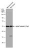 Tubulin Beta 3 Class III antibody, GTX129913, GeneTex, Western Blot image 