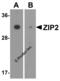 Zinc transporter ZIP2 antibody, 6083, ProSci, Western Blot image 