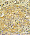 Apolipoprotein L1 antibody, abx033351, Abbexa, Immunohistochemistry paraffin image 