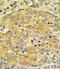 APOL1 antibody, abx033351, Abbexa, Immunohistochemistry paraffin image 