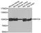 SET And MYND Domain Containing 4 antibody, abx005517, Abbexa, Western Blot image 