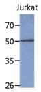 Protein Phosphatase, Mg2+/Mn2+ Dependent 1F antibody, NBP2-42648, Novus Biologicals, Western Blot image 