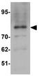 Zinc Finger Protein 219 antibody, GTX31829, GeneTex, Western Blot image 