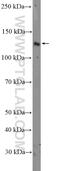 Actin Filament Associated Protein 1 Like 2 antibody, 17183-1-AP, Proteintech Group, Western Blot image 