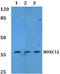 Homeobox C12 antibody, A15490, Boster Biological Technology, Western Blot image 