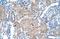 Sep (O-phosphoserine) tRNA:Sec (Selenocysteine) tRNA synthase antibody, A05769, Boster Biological Technology, Immunohistochemistry frozen image 