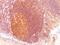 MALT1 Paracaspase antibody, M01599, Boster Biological Technology, Immunohistochemistry paraffin image 
