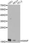 Mesencephalic Astrocyte Derived Neurotrophic Factor antibody, STJ29085, St John