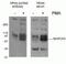 Myristoylated Alanine Rich Protein Kinase C Substrate antibody, 10018-3-AP, Proteintech Group, Western Blot image 